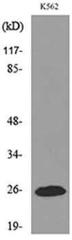 IGFBP6 rabbit pAb Antibody