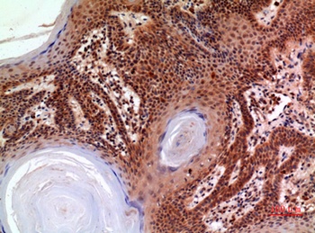 Macroglobulin α-2 rabbit pAb Antibody