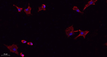 NTCP antibody