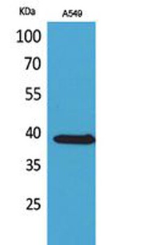NTCP rabbit pAb Antibody