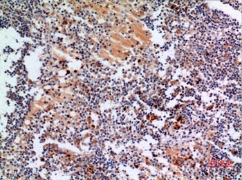 gp91-phox rabbit pAb Antibody
