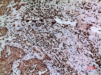 CacyBP rabbit pAb Antibody