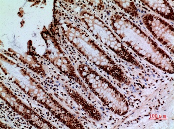 CacyBP antibody