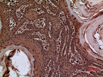 AACT rabbit pAb Antibody