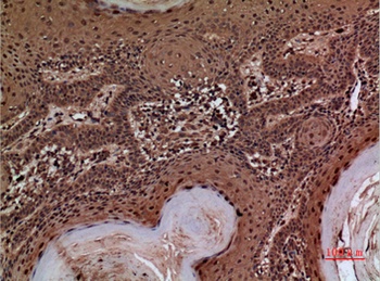 AACT rabbit pAb Antibody