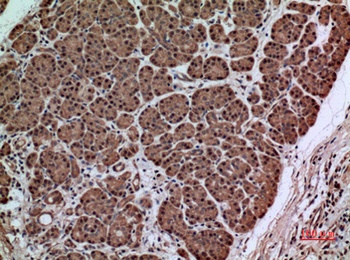 SERPINA3 antibody