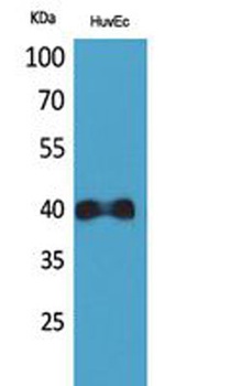 IL8R beta antibody