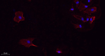 RANKL antibody