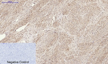 RANKL rabbit pAb Antibody