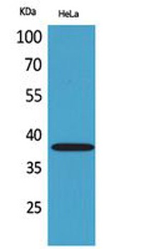 CD158b2/j antibody