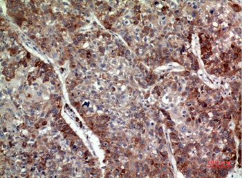 MDA-7 rabbit pAb Antibody