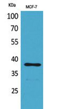 TPO antibody