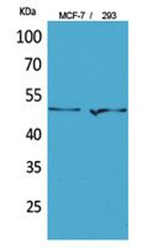 PD-ECGF antibody