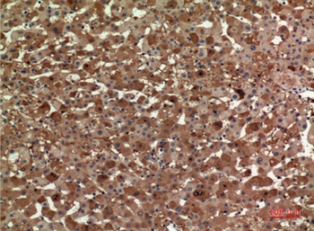 ApoA-I antibody