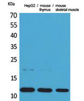 Eotaxin antibody