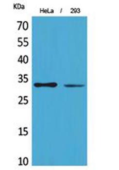 SDHB antibody