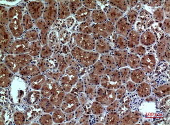 Neuropilin antibody