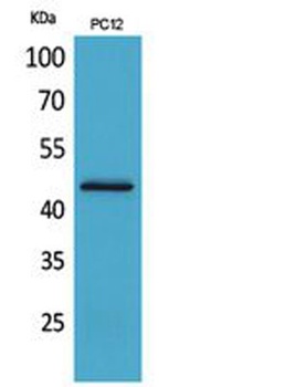 IL1RII antibody