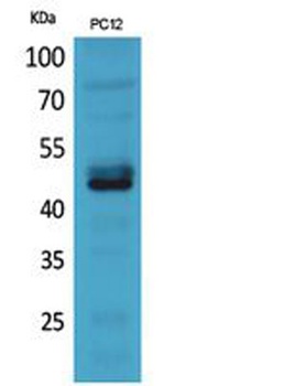 NKp44 antibody