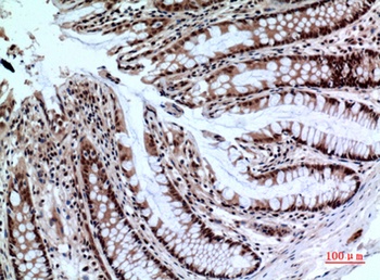 NKp44 rabbit pAb Antibody