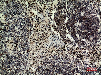 HRP-3 rabbit pAb Antibody