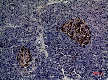 CMTM5 rabbit pAb Antibody