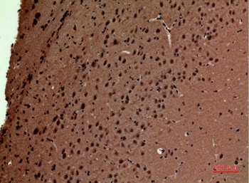 POLR3G rabbit pAb Antibody