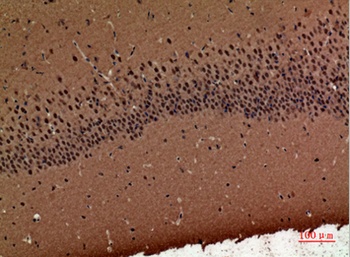 POLR3G rabbit pAb Antibody