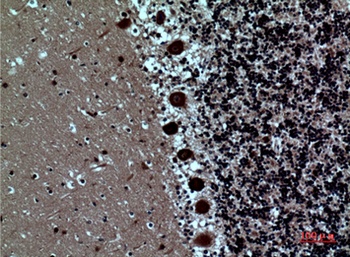 SAMHD1 rabbit pAb Antibody
