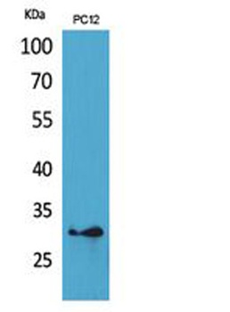 HLA-DQB1/2 antibody