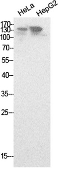 NCoA-3 rabbit pAb