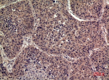 IL1F8 antibody