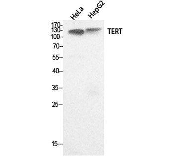 TERT antibody