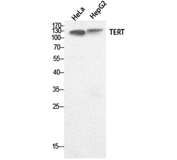 TERT rabbit pAb Antibody