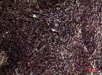 TERT rabbit pAb Antibody