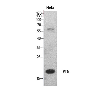 PTN antibody