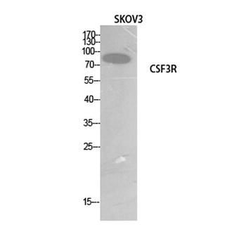 G-CSFR antibody