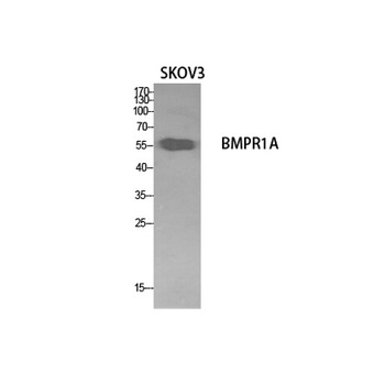 CD292 antibody