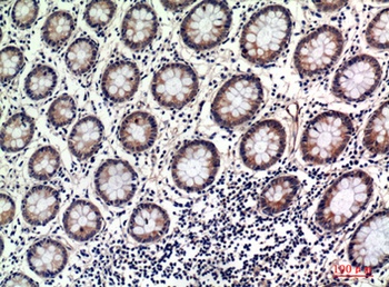 OAS2 rabbit pAb Antibody