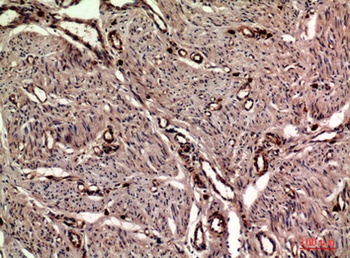 OAS2 rabbit pAb Antibody