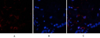 Ub antibody