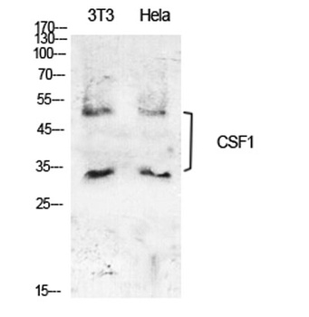 M-CSF antibody