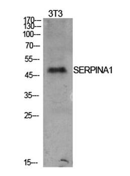 alpha 1 Antitrypsin antibody