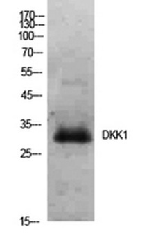 Dkk-1 rabbit pAb