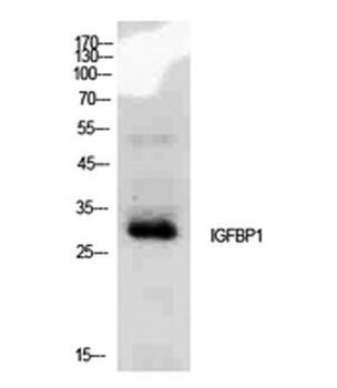 IGFBP1 rabbit pAb