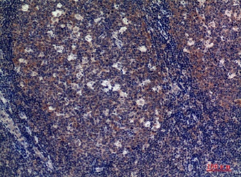 CD89 rabbit pAb Antibody