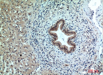 PPP1R15B rabbit pAb Antibody