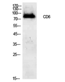 CD6 antibody