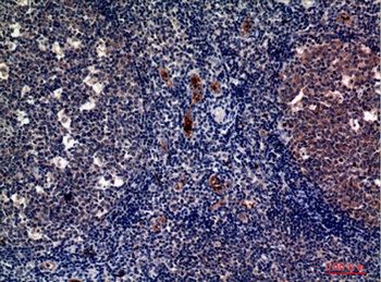 P-Selectin rabbit pAb Antibody