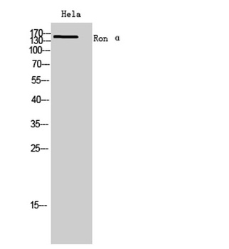 Ron α rabbit pAb Antibody